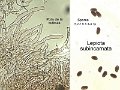 Lepiota subincarnata-amf1215-micro